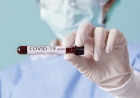 Planos de saúde são obrigados a  fornecer testes de Covid-19