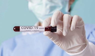 Planos de saúde são obrigados a  fornecer testes de Covid-19