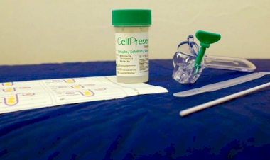 Unidades de Saúde passam a oferecer  teste molecular para detecção do HPV
