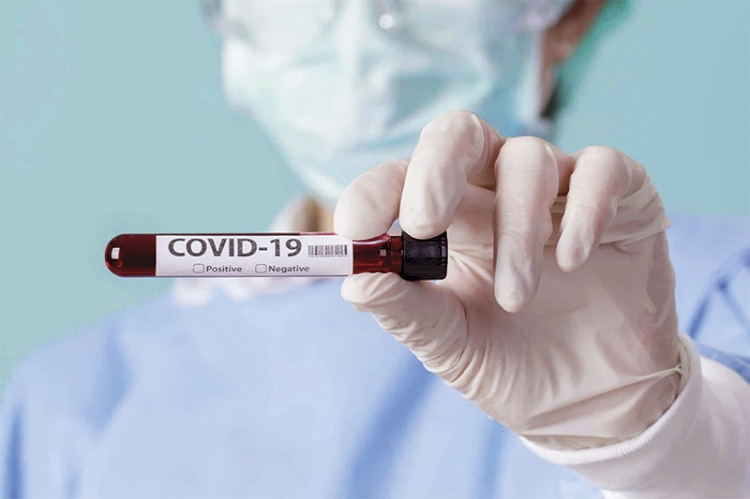16 novos casos de Covid-19 em Três de Maio